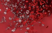 Beta thalassemia: toward a more effective therapeutic strategy