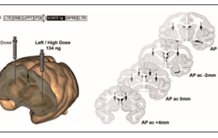 Three-dimensional histology for PET quantification of brain imaging