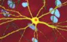 Huntington : la neurodégénérescence du striatum expliquée