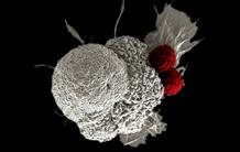 HLA-G : une nouvelle cible thérapeutique anti-cancéreuse