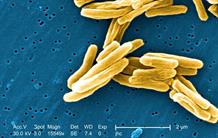La recherche européenne s’organise contre la tuberculose