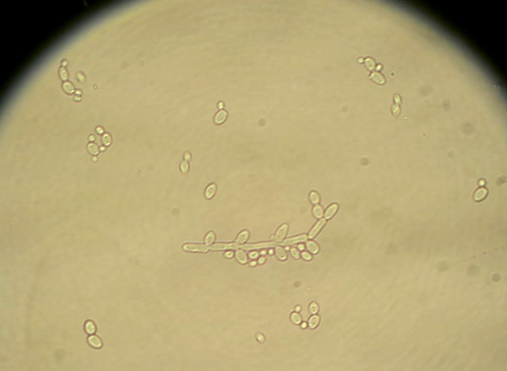 Le champignon Candida albicans peut provoquer des infections au niveau des muqueuses digestive et gynécologique.