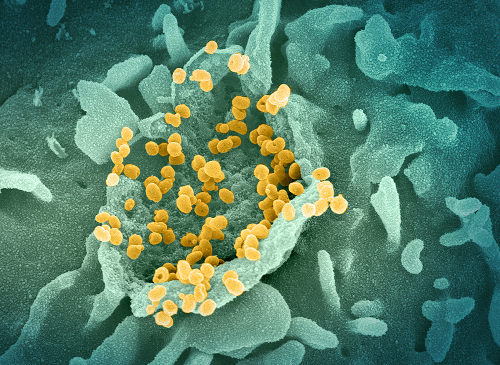 Des particules virales de SARS-CoV-2 émergent de cellules en culture, en microscopie électronique