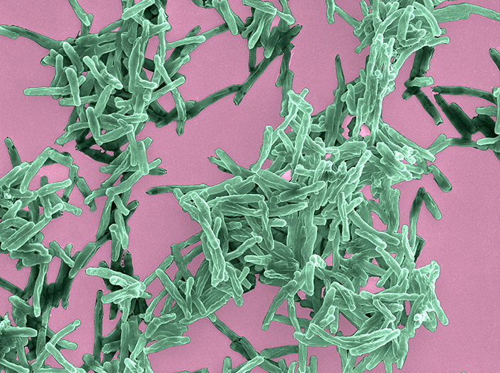 Mycobacterium tuberculosis, agent de la tuberculose, en microscopie électronique (image colorisée)