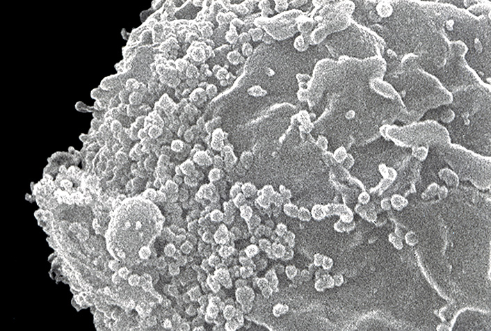 Virus VIH-1, agent du SIDA, à la surface d'un lymphocyte T, en microscopie électronique