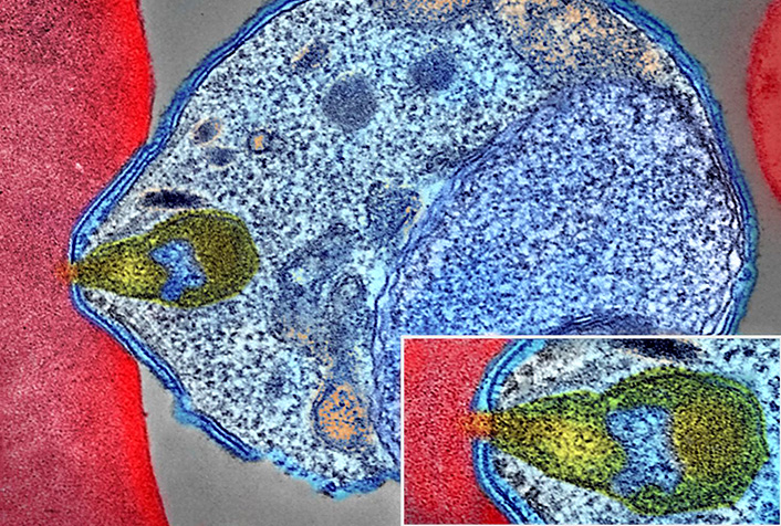 Parasite du paludisme (en bleu) se fixant sur un globule rouge humain (en rouge) en microscopie électronique. L'encart montre un détail du point d'attachement à plus fort grossissement. 