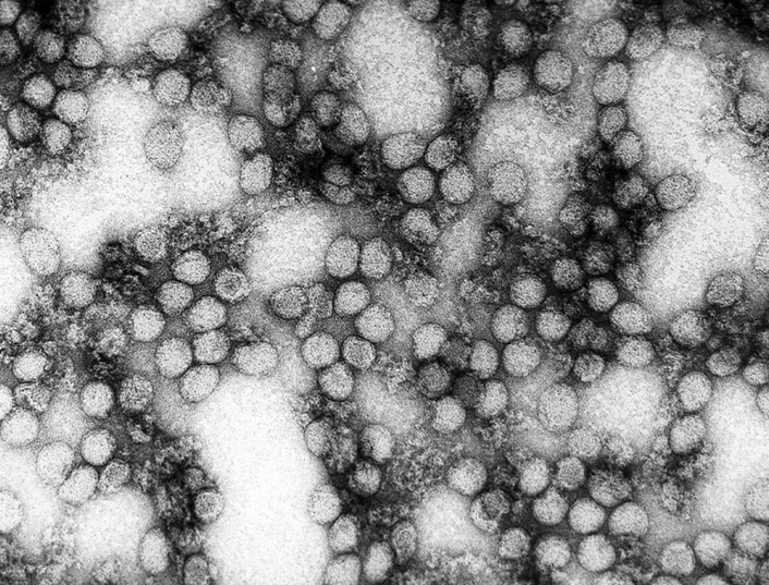 Virus de la fièvre jaune, en microscopie électronique