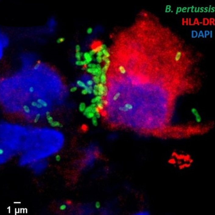 Cellule immunitaire activée (en rouge) reconnaissant des bactéries (Bordetella pertussis responsable de la coqueluche, en vert) pour les éliminer, en microscopie à fluorescence. Les noyaux des cellules sont colorés en bleu.