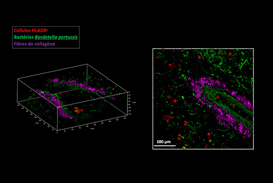 Visualisation de pathogènes (en vert), et de cellules de l'immunité (en rouge) directement dans les tissus (dont certaines protéines sont marquées en violet pour se repérer) grâce au microscope biphoton.