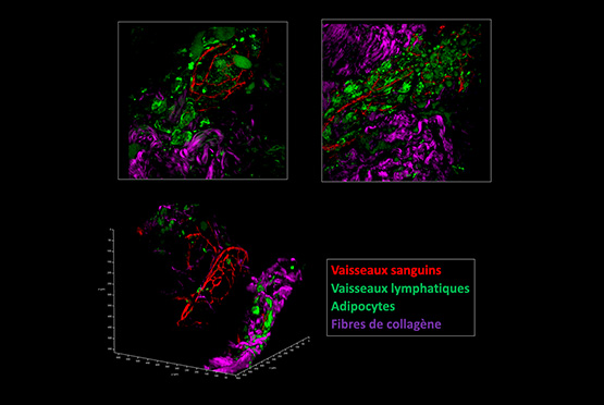 Visualisation des vaisseaux sanguins (en rouge), des cellules graisseuses et vaisseaux qui drainent les cellules immunitaires (en vert) dans un échantillon de peau (dont certaines protéines sont marquées en violet pour se repérer) en microscopie biphotonique.