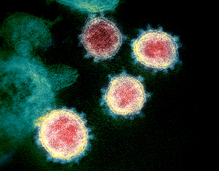 Le virus SARS-CoV-2, responsable de la Covid-19, en microscopie électronique à transmission.