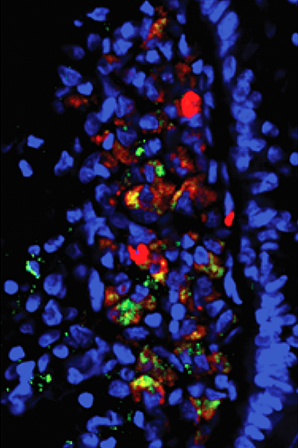 Molécules (en rouge) et cellules (en vert) du système immunitaire dans une section d'intestin (noyaux des cellules intestinales en bleu) infecté par le virus de l'immunodéficience simienne, en microscopie.