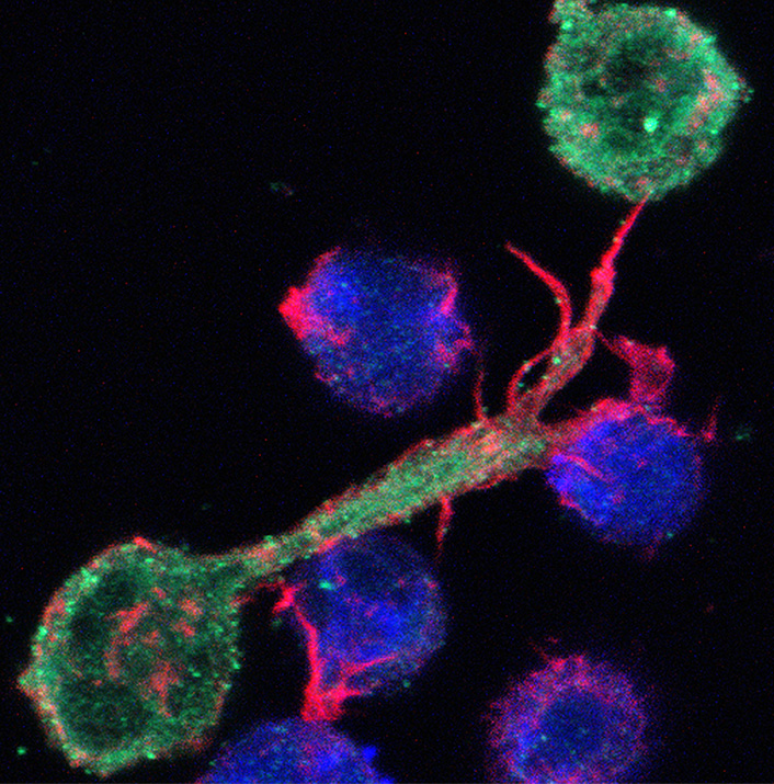 Transfert de virus VIH entre lymphocytes T, en microscopie à fluorescence.
