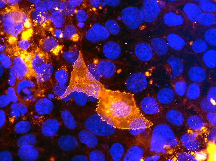 Détection du virus chikungunya (en orange) dans des cellules humaines (noyaux en bleu) en culture en microscopie à fluorescence.