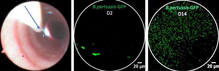 Suivi dans les poumons de la progression de la bactérie (rendue fluorescente en vert) responsable de la coqueluche, par un système de fibre optique équipée d'un microscope (flèche, à gauche).