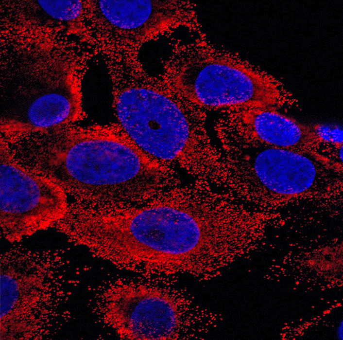 Détection de virus de la fièvre jaune (en rouge) dans des cellules de foie humain infectées (noyaux en bleu).